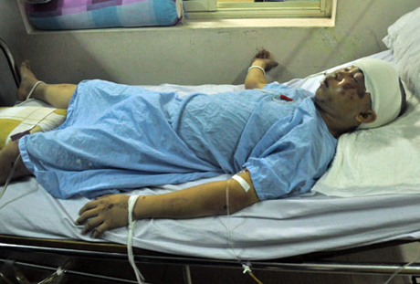 Anh Lâm đang được điều trị tại bệnh viện Việt Đức